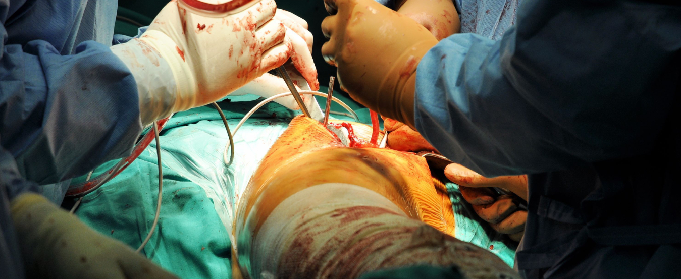 Complex trauma surgeries